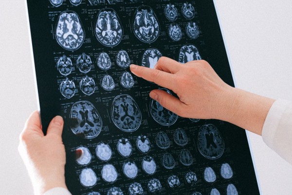 Brain Category For Guest Post Submission