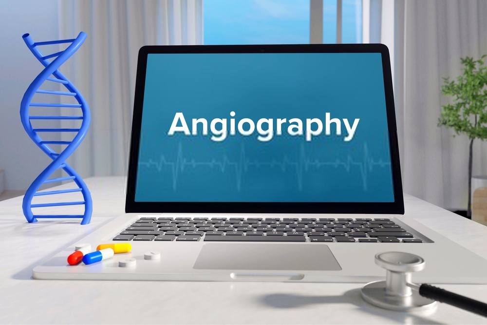 What Is Angiography?