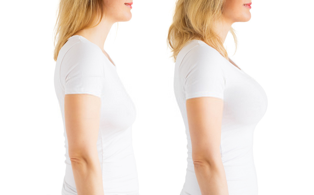 What Are All The Benefits Of Breast Augmentation?